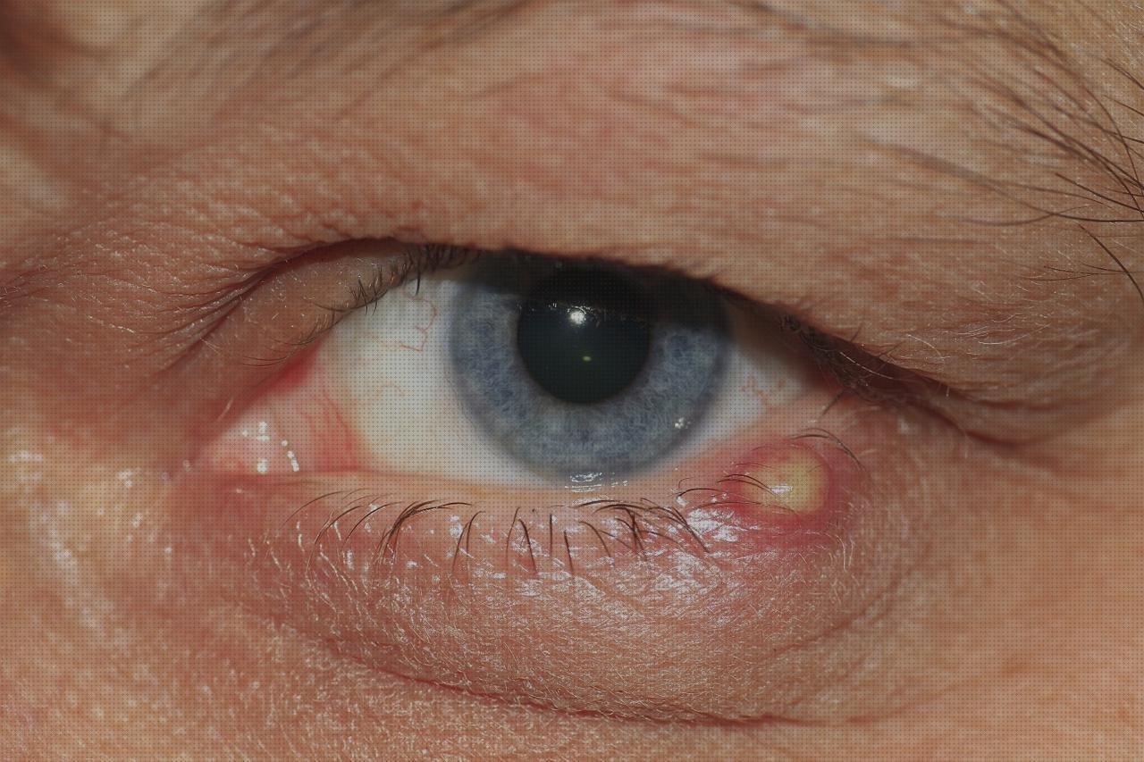 Las mejores Mas vendas elásticas rodillas vendas inflamación vendas