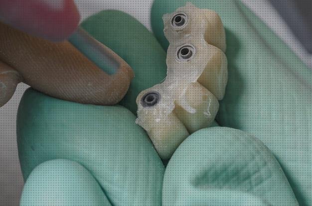 Review de irrigador dental dentadura postiza fija