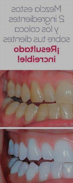 Las mejores encias irrigador dental encias retraidas
