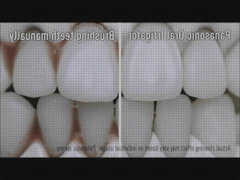 Los 27 Mejores Irrigadores Dentales Panasonic Hb845 Manuales