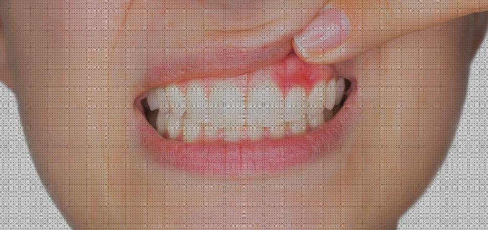 Las mejores irrigadores irrigador dental sangrado encías