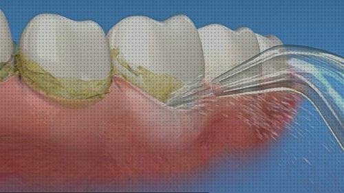 ¿Dónde poder comprar waterpik irrigador dental irrigador dental waterpik 662?