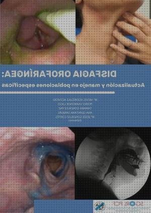 Opiniones de los 3 mejores Laringoscopia Directas Y Aumentos Tonos Vagal