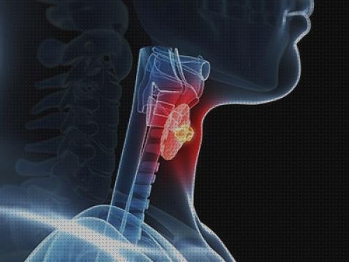 5 Mejores laringoscopia para tiroidectomia del mundo