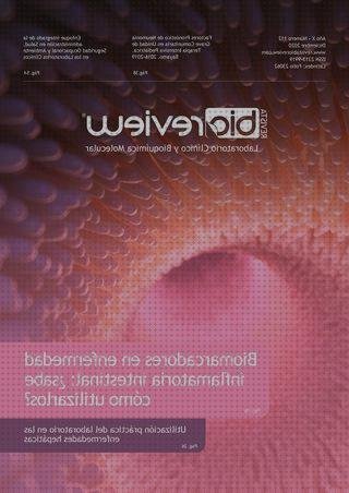 Los 13 Mejores lavaojos laboratorios biomedico a la venta