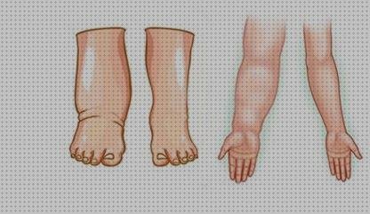 Los 19 Mejores Linfedema Y Medias De Compresiones