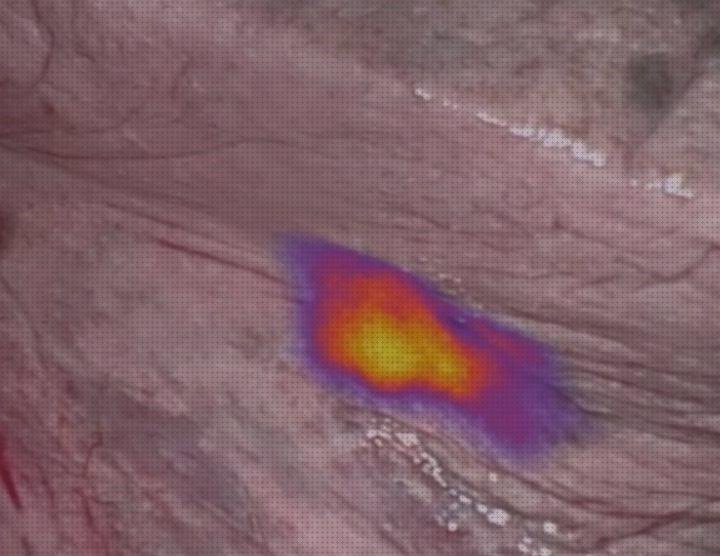 Las mejores marcadores