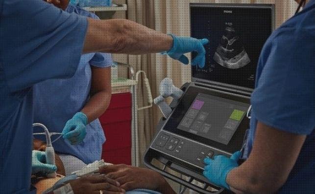 Las mejores marcas de ecografos medicine