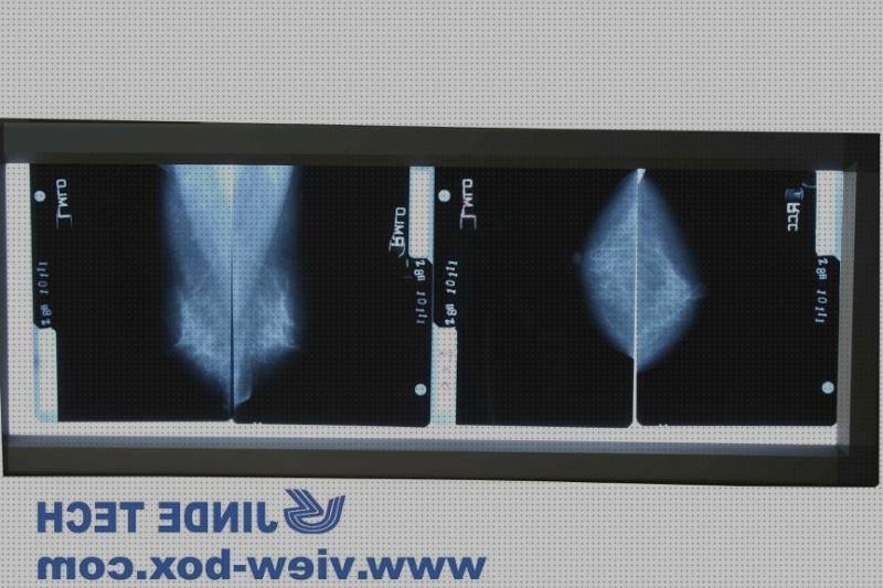 ¿Dónde poder comprar negatoscopio negatoscopio para mamografía de alta frecuencia?