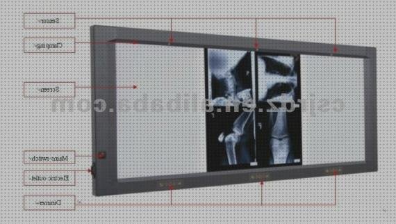 TOP 23 negatoscopio radiografia del mundo