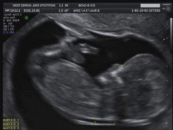 ¿Dónde poder comprar doppler obstetrica?