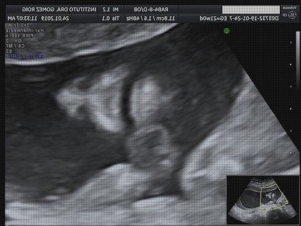 Las mejores doppler obstetrica