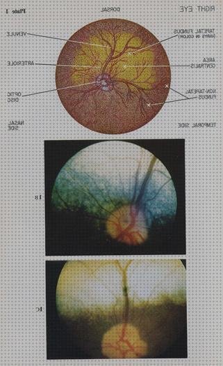 Los mejores 8 Oftalmoscopio Fondos De Ojos Para Perros