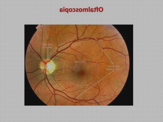 ¿Dónde poder comprar numeros oftalmoscopio numeros?