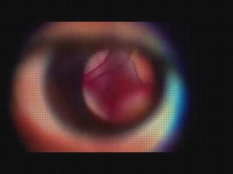 Review de los 8 mejores oftalmoscopio numeros a la venta