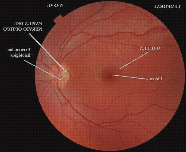¿Dónde poder comprar oftalmoscopio digital oftalmoscopio ojo?