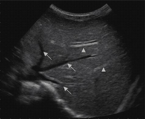 ¿Dónde poder comprar Mas eco doppler de vasos placentarios Mas explicación eco doppler medicina Mas eco doppler transtoracico onda bifasica en eco doppler en suprahepáticas?