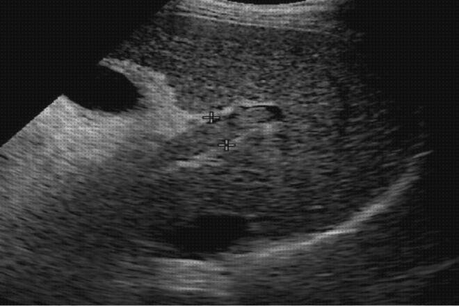 Las mejores marcas de Mas eco doppler de vasos placentarios Mas explicación eco doppler medicina Mas eco doppler transtoracico onda bifasica en eco doppler en suprahepáticas