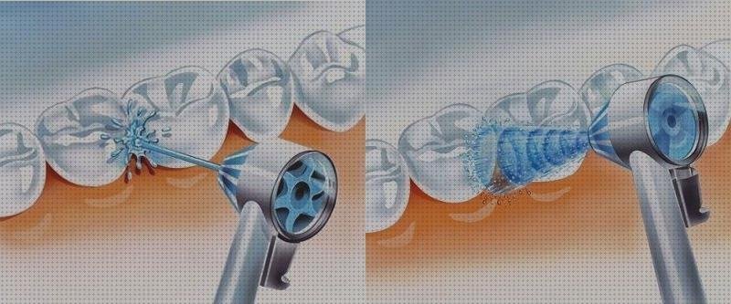 Opiniones de las 14 mejores Orales B Irrigad Dentales Waterjet Md16