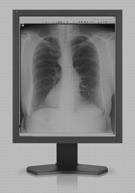 Mejores 13 pantallas médicos