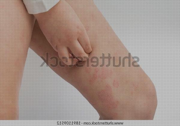 Review de picor y pelar piel vendas