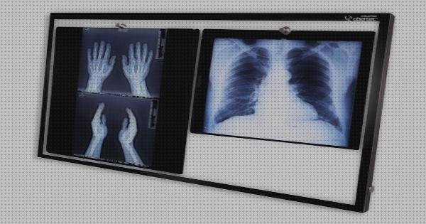 Opiniones de los 21 mejores Radiografia Con Y Sin Negatoscopio