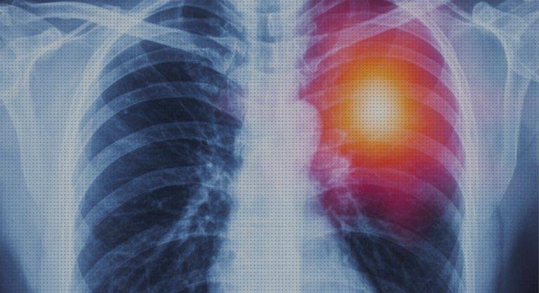 ¿Dónde poder comprar electrocardiograficos signos electrocardiograficos de angina?