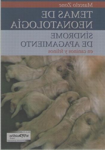 Las mejores tensiometros tensiometro felino