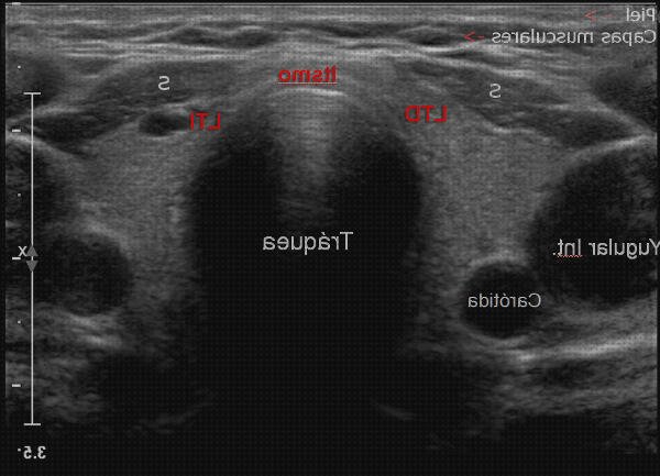 Review de los 11 mejores tiroides ecos doppler para comprar