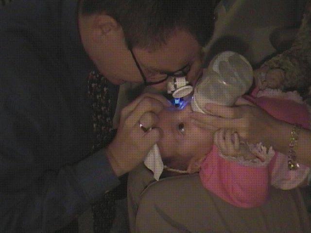 Las mejores perkins tonometro tonometro de perkins niños