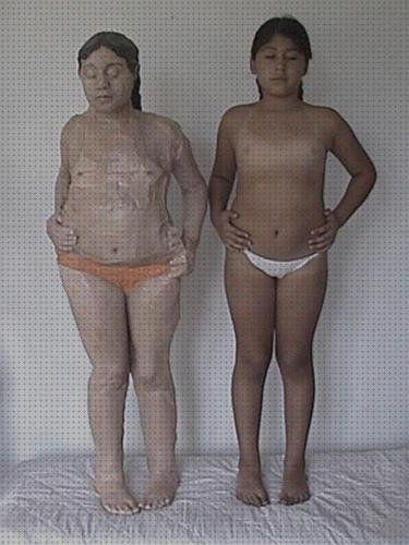 Review de torso humano con vendas de escayola