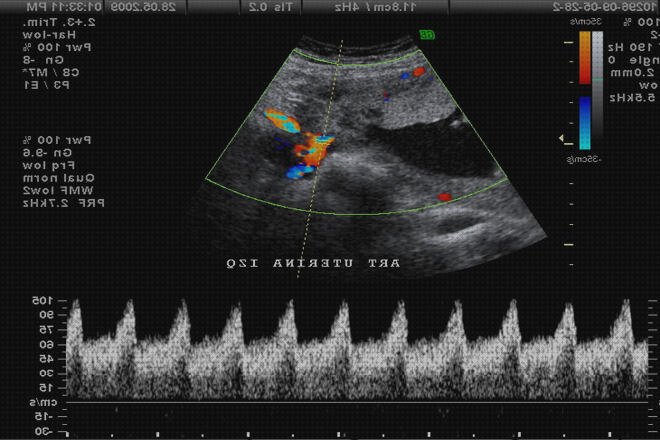 ¿Dónde poder comprar doppler uterino?