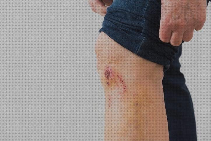 Review de vendas rodillas tapar cicatriz