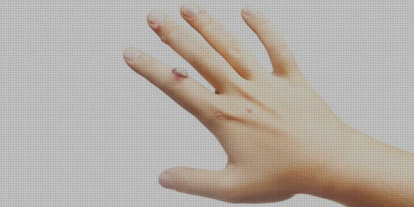 ¿Dónde poder comprar verrugas bisturi verrugas quite a con bisturi electrico?